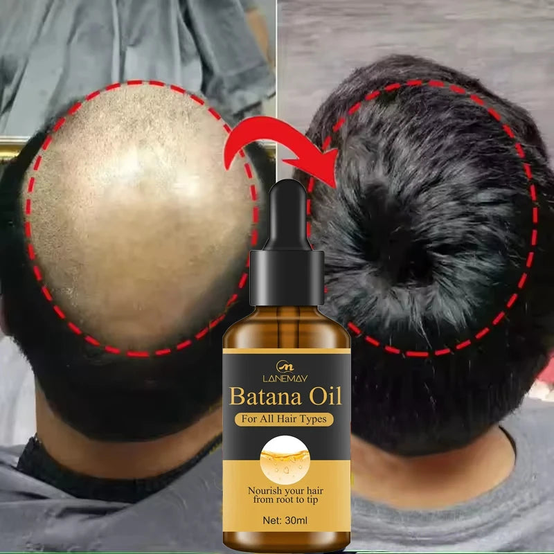 Batana Hair Growth Essential Oil